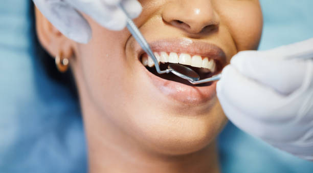 Best Mobile Emergency Dentist in Red Corral, CA